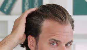 掉头发的主要原因有哪些？掉头发是如何出现的？