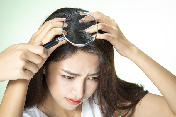 青春期的女生掉头发厉害是什么原因，怎么缓解？