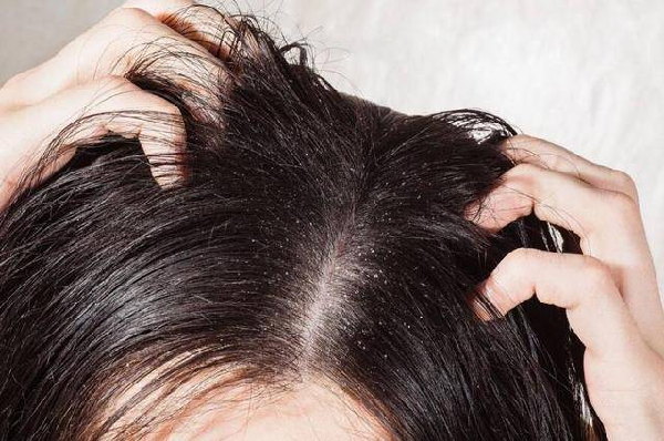 头发稀疏情况越来越普遍，那么可以种头发吗？