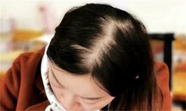 毛发移植技术有哪些？毛发种植哪个好？