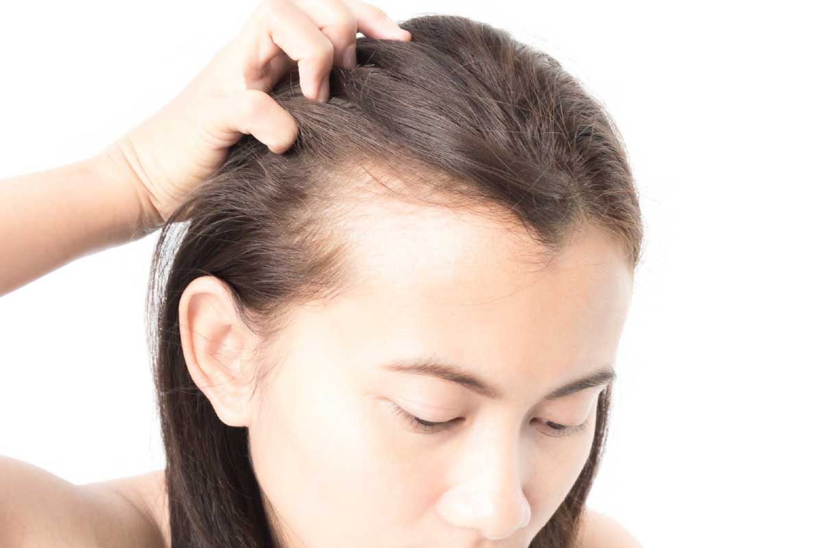 女性脱发的原因有哪些 怎么才能有效防脱