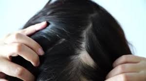 头发移植对人体有害吗?毛发移植有哪些禁忌？
